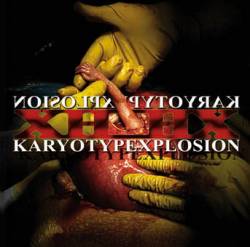 XHOHX : Karyotypexplosion