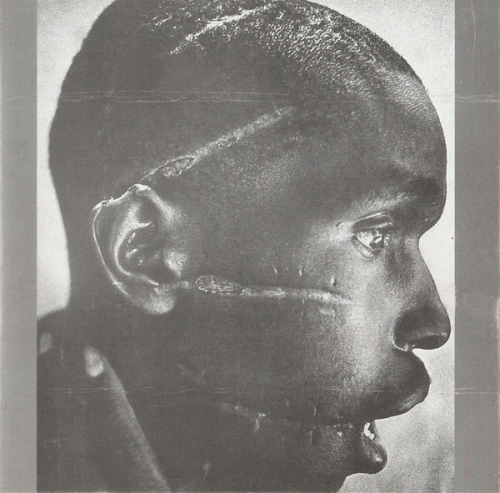 Abreast : Scars Abreast : Scars