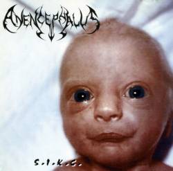 Anencephalus : S.I.K.C.