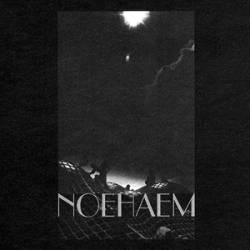 Anenzephalia : Noehaem
