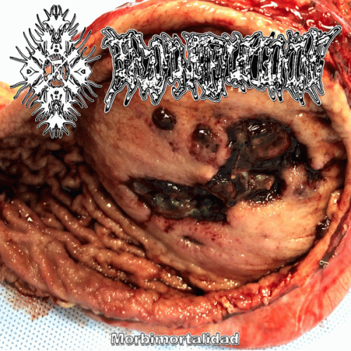 Benzoylmethylecgonine : Morbimortalidad