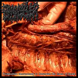 Brainspewer : Postmortem Brainspewer : Postmortem