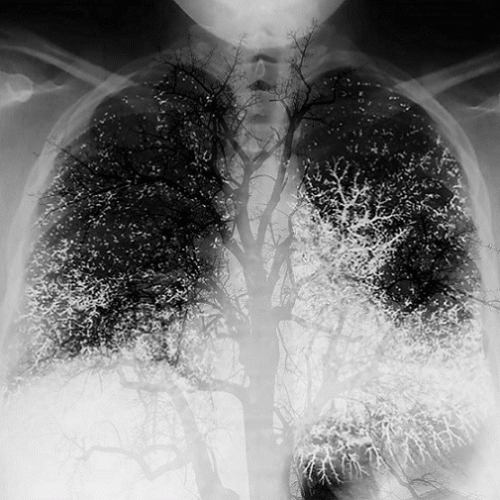 Diespnea : Immortale