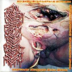 Dismenorrea : D.I.S.M.E.N.O.R.R.E.A.