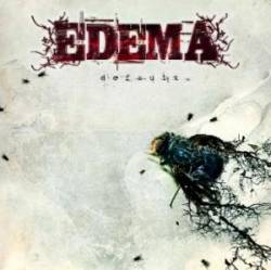 Edema : Default