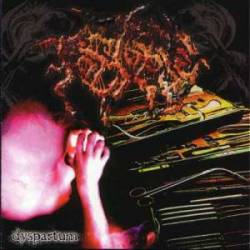 Foetopsy : Dyspartum