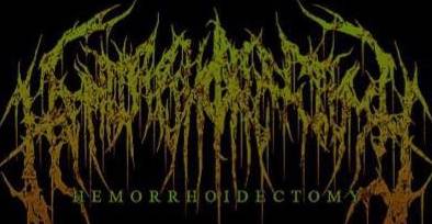 logo Hemorrhoidectomy