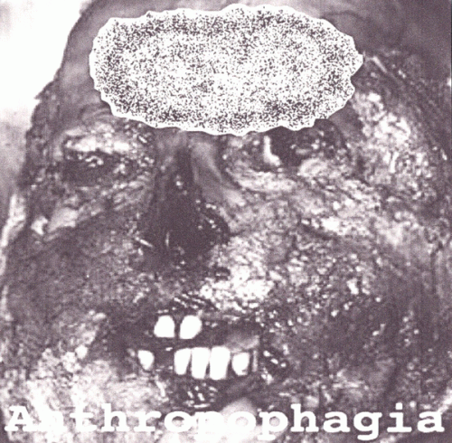 Hydroencephalocystocele : Anthropophagia