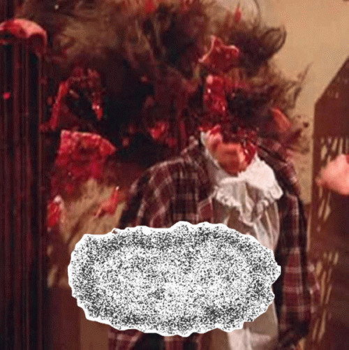 Hydroencephalocystocele : Hydroencephalocystocele.