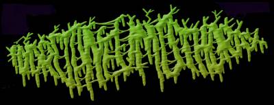 logo Hydropneumothorax