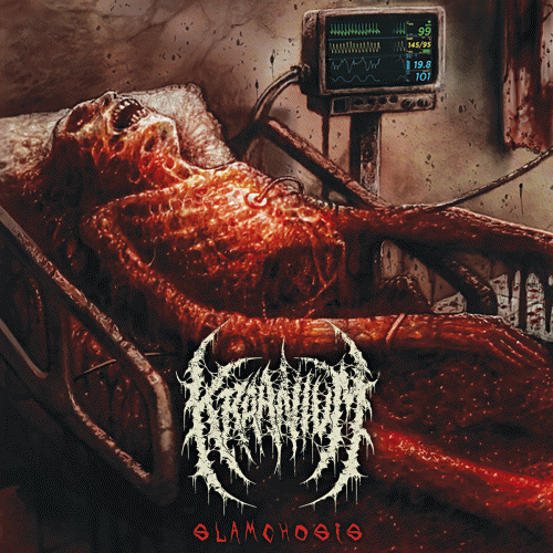 Kraanium : Slamchosis