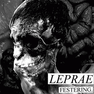 Leprae : Festering