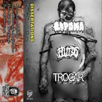 Lipoma : Dissertations