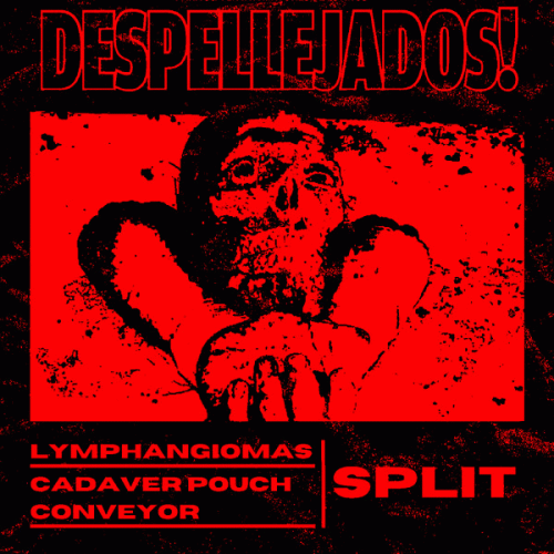 Lymphangiomas : Despellejados! Lymphangiomas : Despellejados!