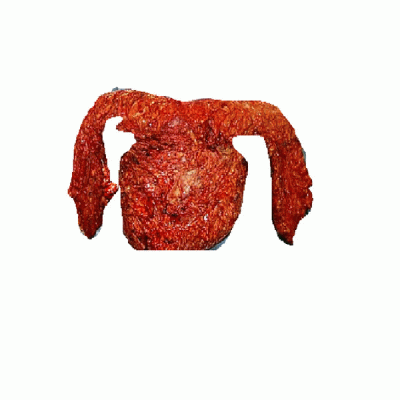 logo Megacoloncancer