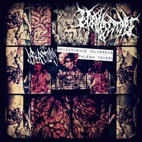 Nephrectomy : Consequence