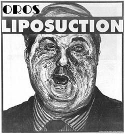 Oros (SVK) : Liposuction