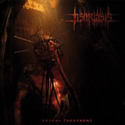 Psoriasis : autolink href=