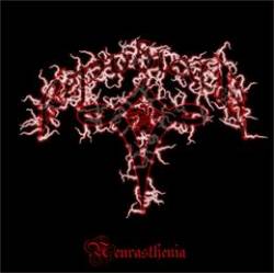 Neurasthenia
