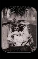 Senthil : Septisemesis