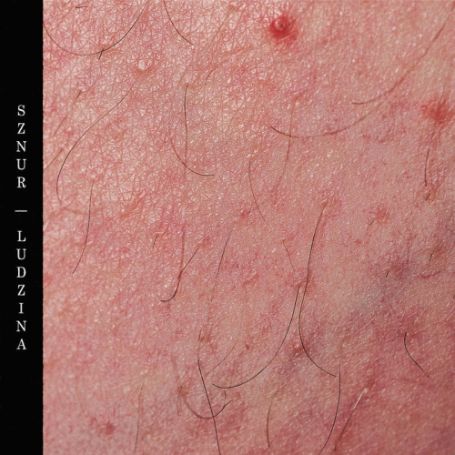 Sznur : Ludzina