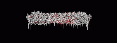 logo Ulceropulcopronecrobiovulpectomy